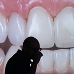 conservative-rehabilitation-of-tooth