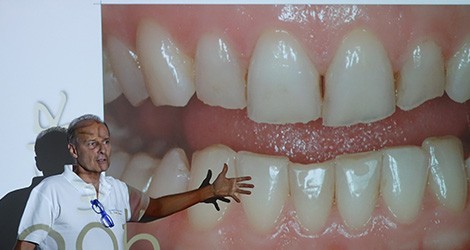 conservative rehabilitation of tooth