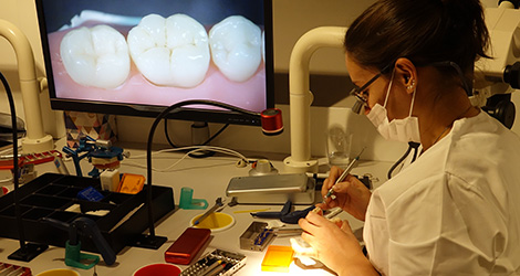conservative rehabilitation of tooth