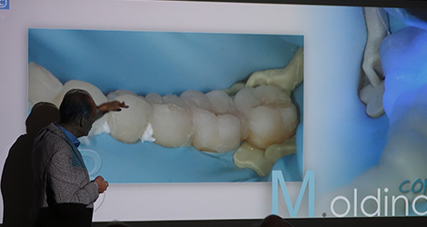 conservative rehabilitation of tooth