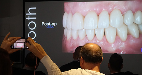 conservative rehabilitation of tooth