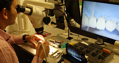 conservative rehabilitation of tooth