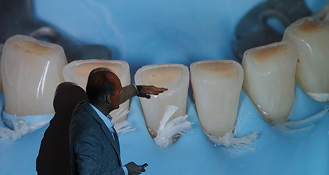 conservative rehabilitation of tooth