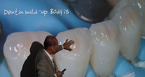 conservative rehabilitation of tooth