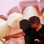 conservative-rehabilitation-of-tooth